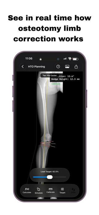 OsteoPlan Screenshot 2 of 10