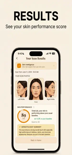 Strata Skin screenshot 2