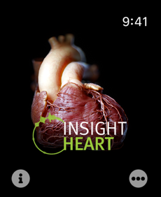 INSIGHT HEART Screenshot