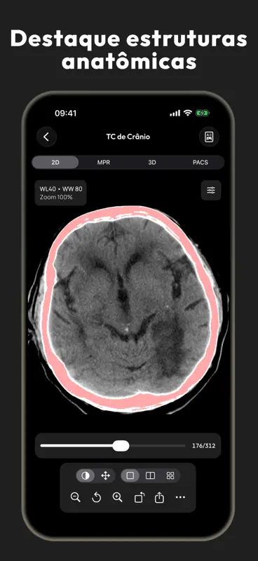 Visor DICOM - MesDICOM screenshot 4 of 8