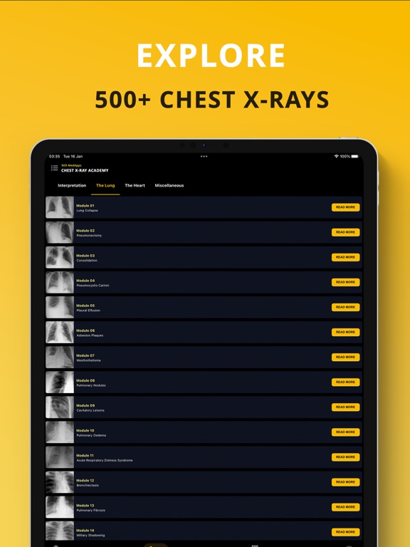 Chest X-ray Academy: Learn CXRのおすすめ画像1
