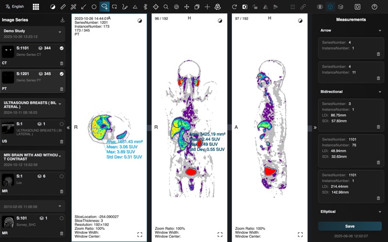 Dicom Browser Screenshot