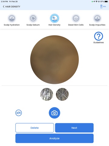ChoiceDx Pico Scalp iPad screenshot