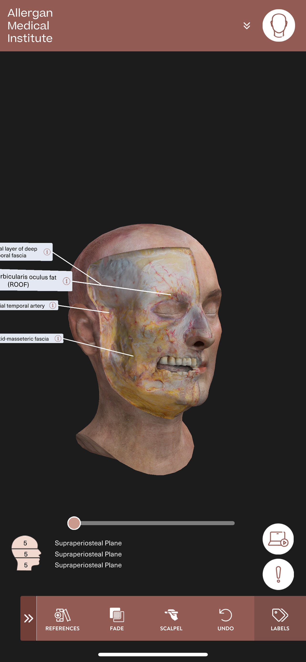 AMI Essentials: 3D Anatomy TR screenshot 8