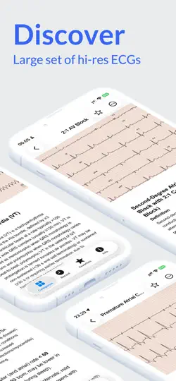Screenshot von ECG Atlas auf dem iPhone 2