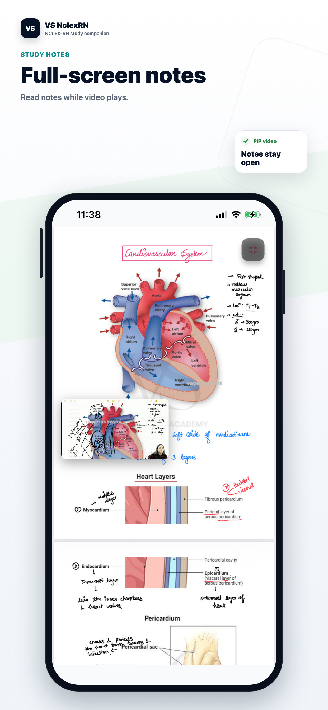 VS NclexRN screenshot 5