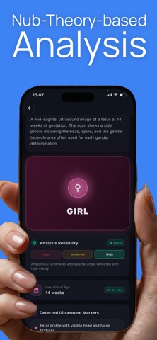 NubScan: Baby Gender AI iPhone screenshot