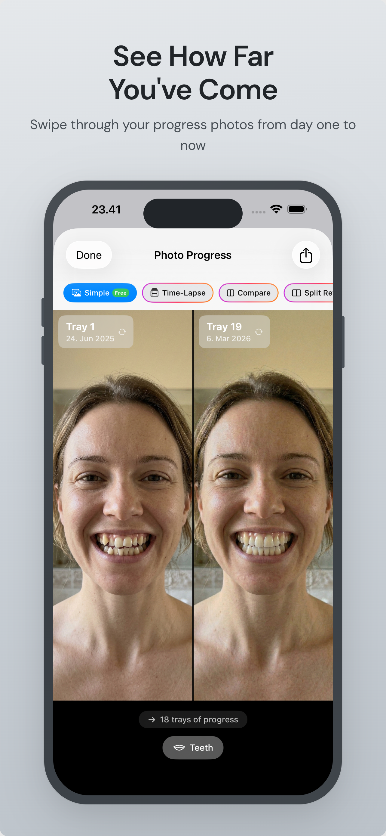 Smile Journey: Aligner Tracker
