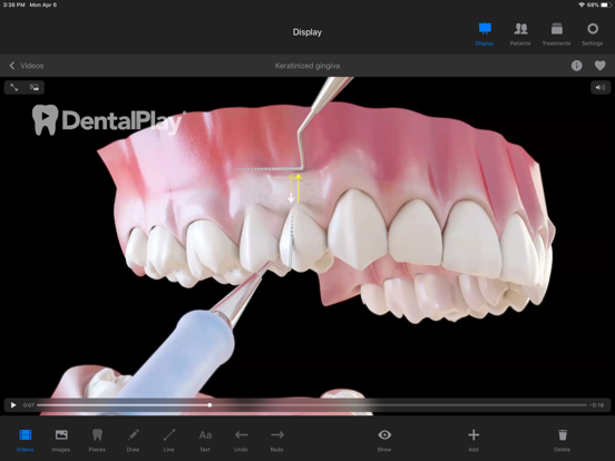 Screenshot #5 pour Dentool