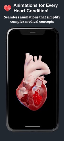HeartVision Screenshot 3 of 3