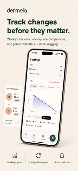 Mole Checker: Skin Analyzer screenshot 4