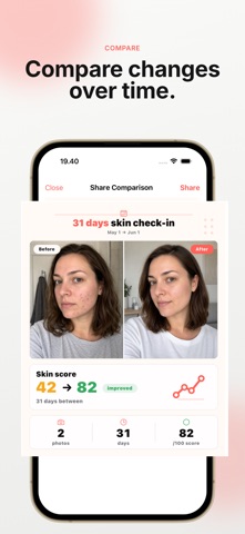 Claro: Acne Tracker iPhone screenshot