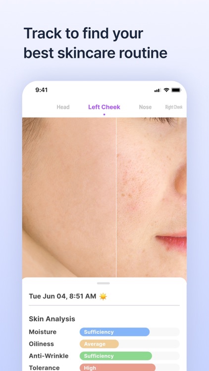 Skinlog | Acne diary screenshot-4