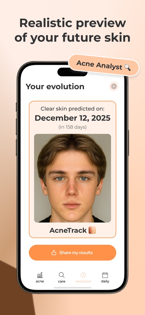 AcneTrack – Your Acne Journey - This tool provides a personalized 'Clear skin predicted on' date and features an 'Acne Analyst' section for deeper insights into future skin health.