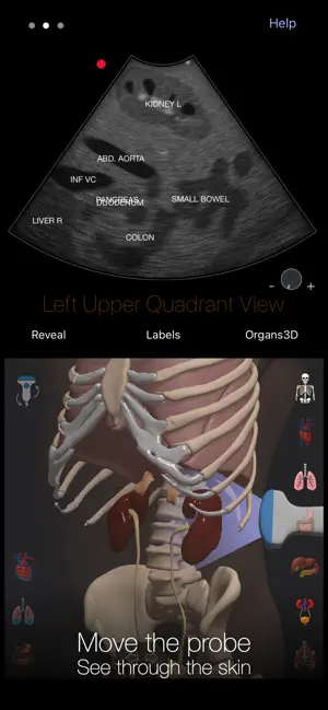 PoCUS Pocket Trainer screenshot 1