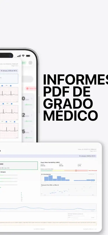 HeartLab: 心電図プロ分析 screenshot 6 of 8