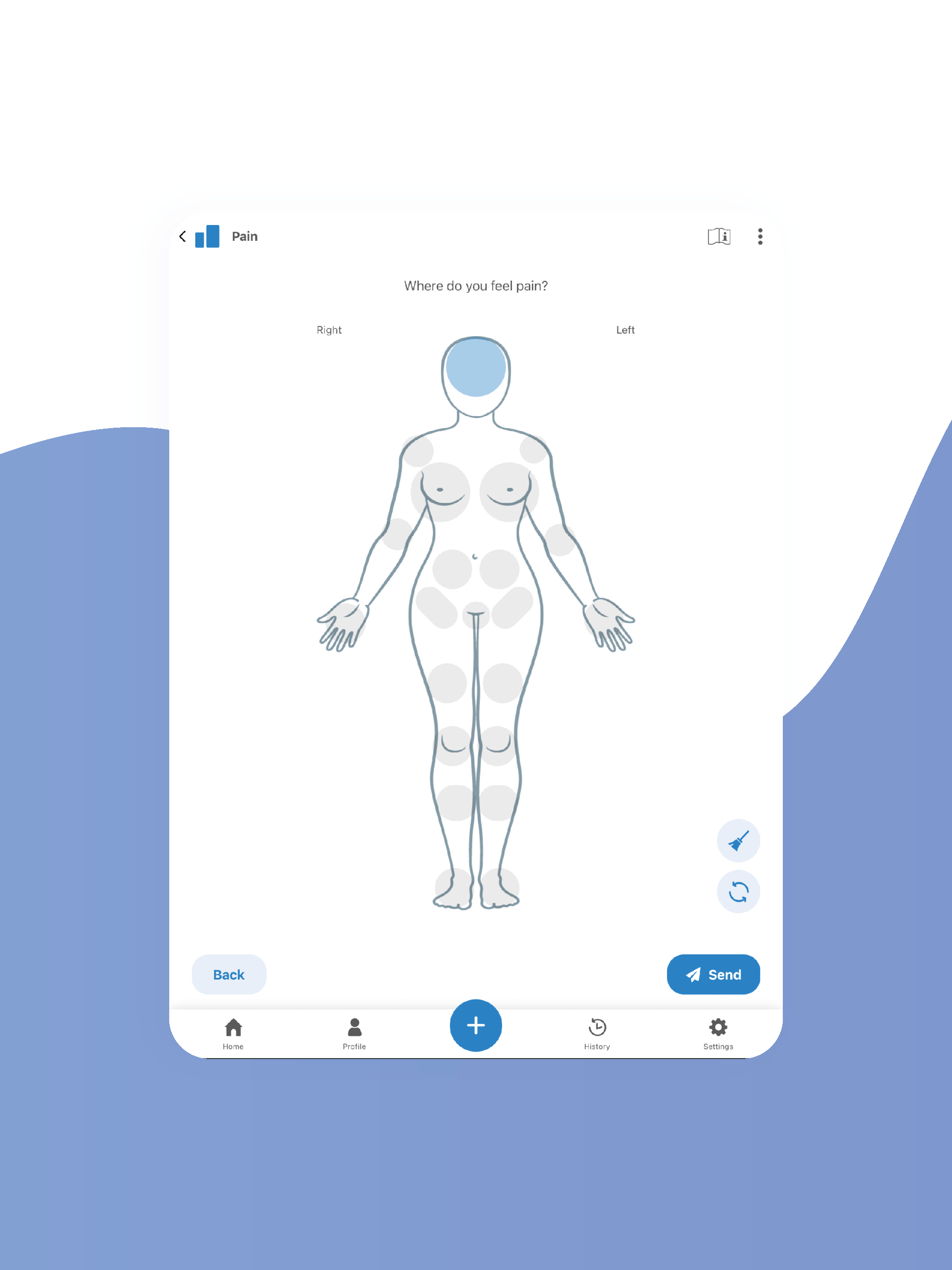 Step Oncology