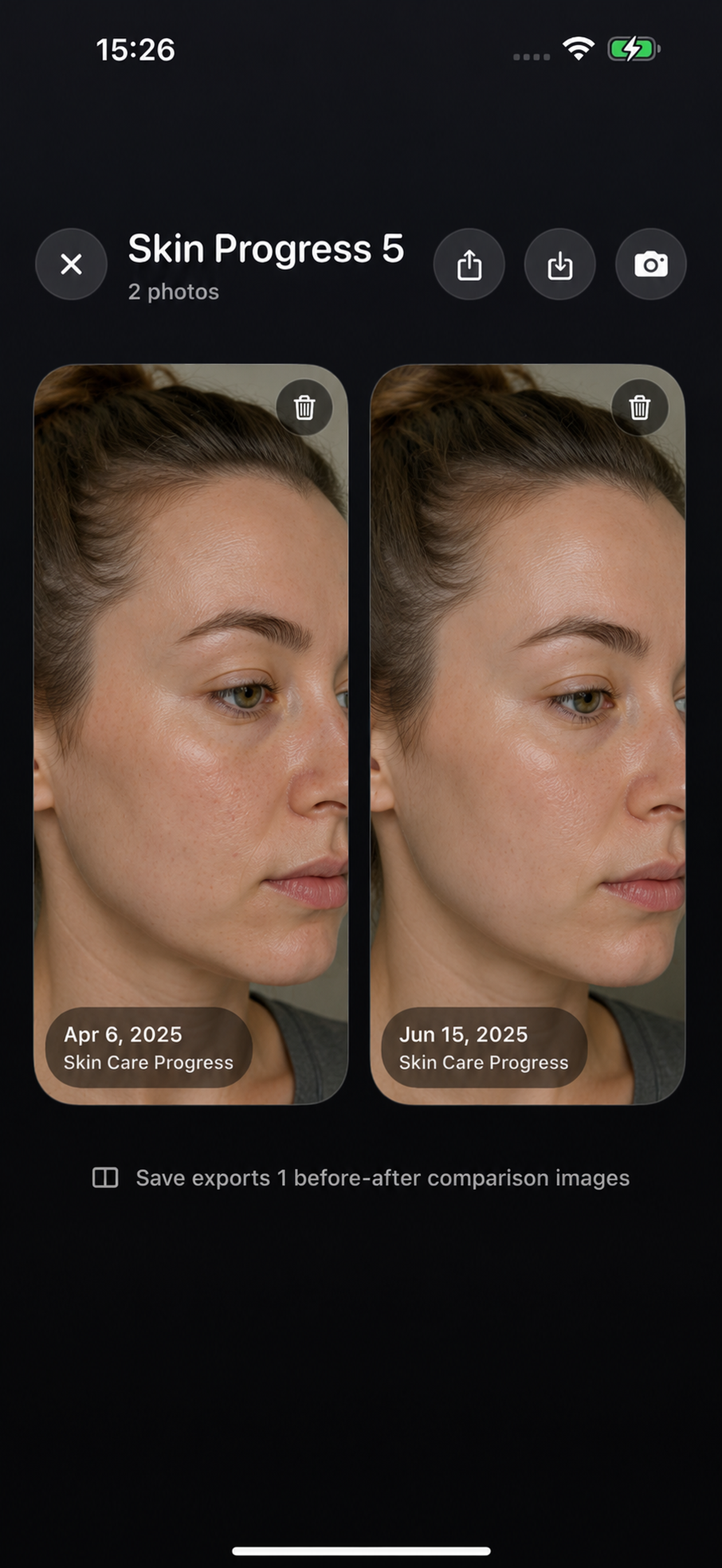Progress Photos: Body Tracker screenshot 5