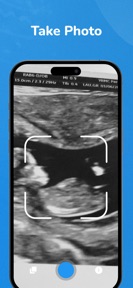 Baby Gender Scanner AI + screenshot