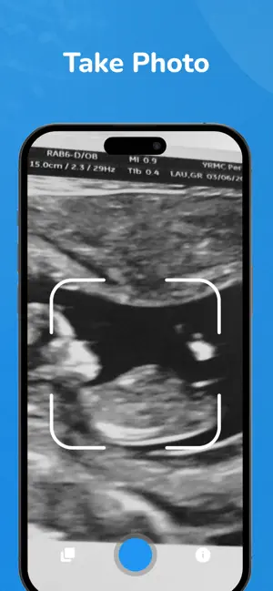 Baby Gender Scanner AI + screenshot 2
