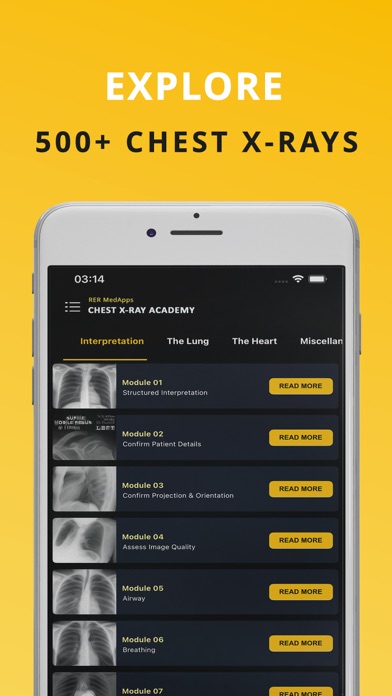Chest X-ray (CXR) Made Easy Screenshot