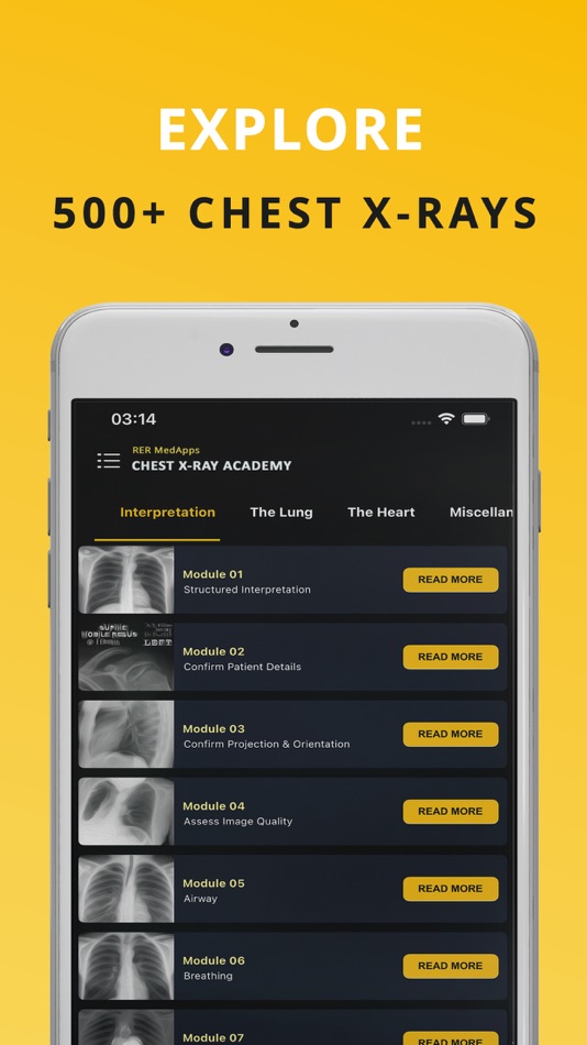 #3. Chest X-ray (CXR) Made Easy (iOS) Podle: RER MedApps
