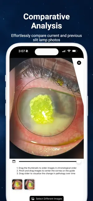 Slit Lamp Camera screenshot 2