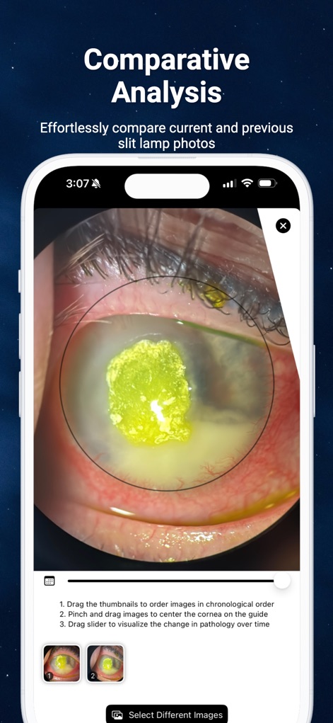 Slit Lamp Camera - Medical App | MWM