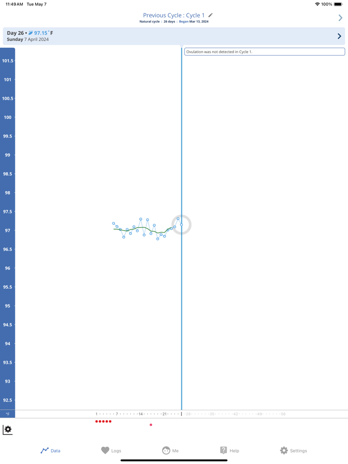 OvuSense Cycle  PCOS Tracker