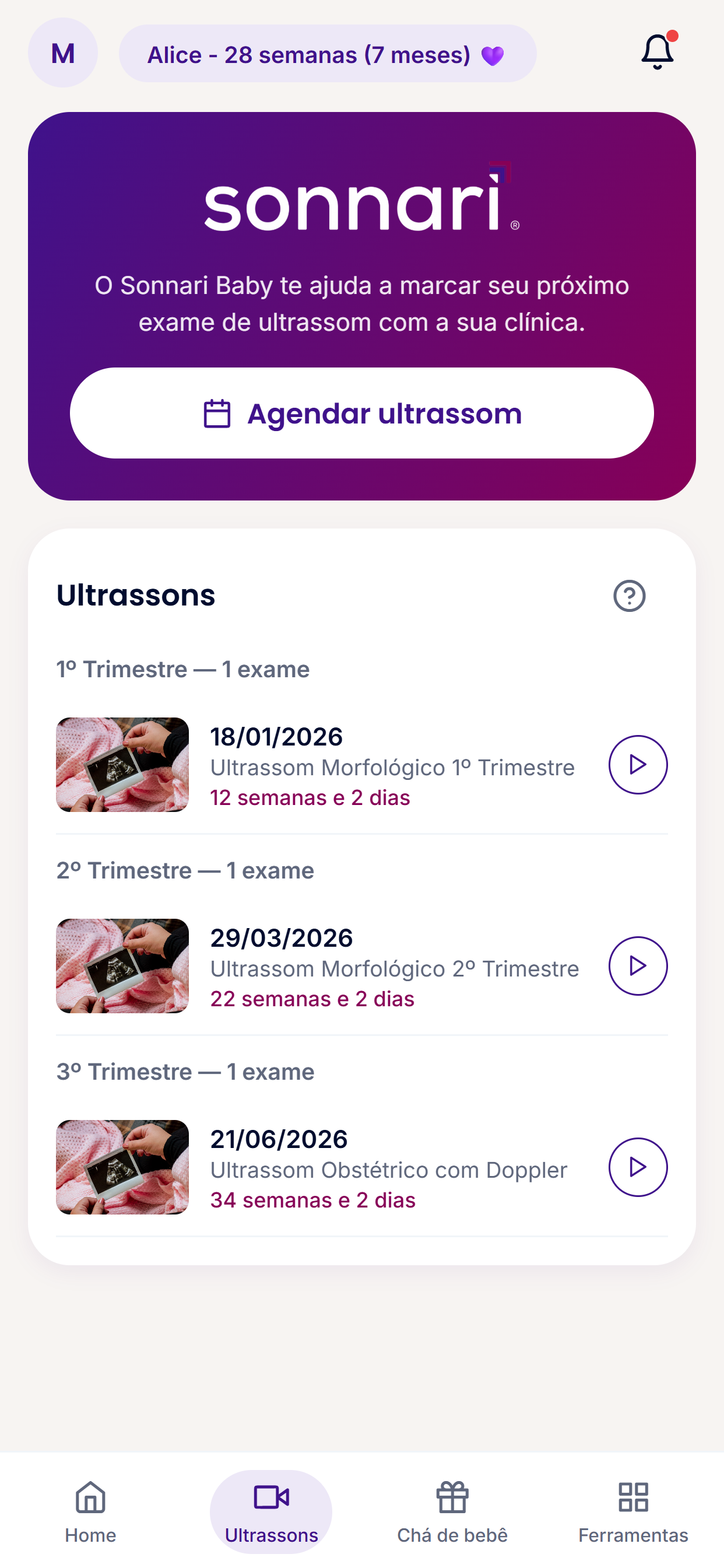 Sonnari Baby screenshot 4