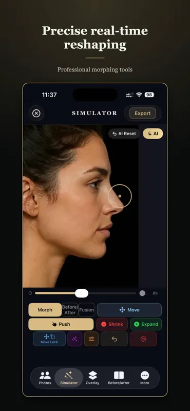 Rhinoplasty Simulator Pro screenshot 3 of 6