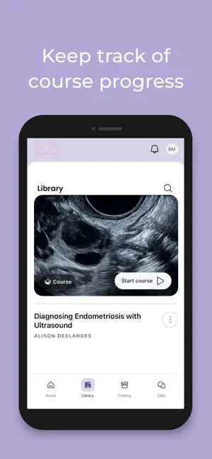 AIMEE: My Ultrasound Mentor screenshot 3