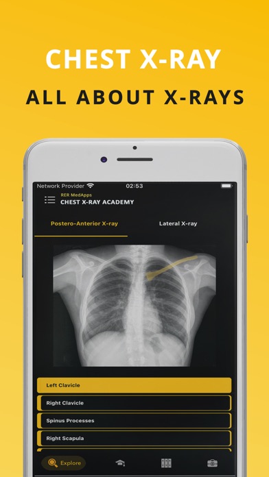 Chest X-ray (CXR) Made Easy Screenshot
