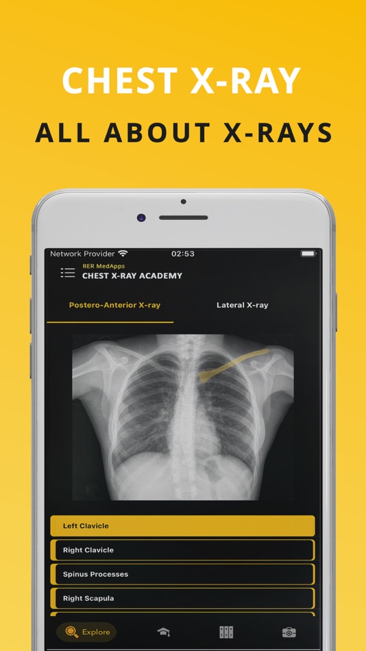 #1. Chest X-ray (CXR) Made Easy (iOS) Podle: RER MedApps
