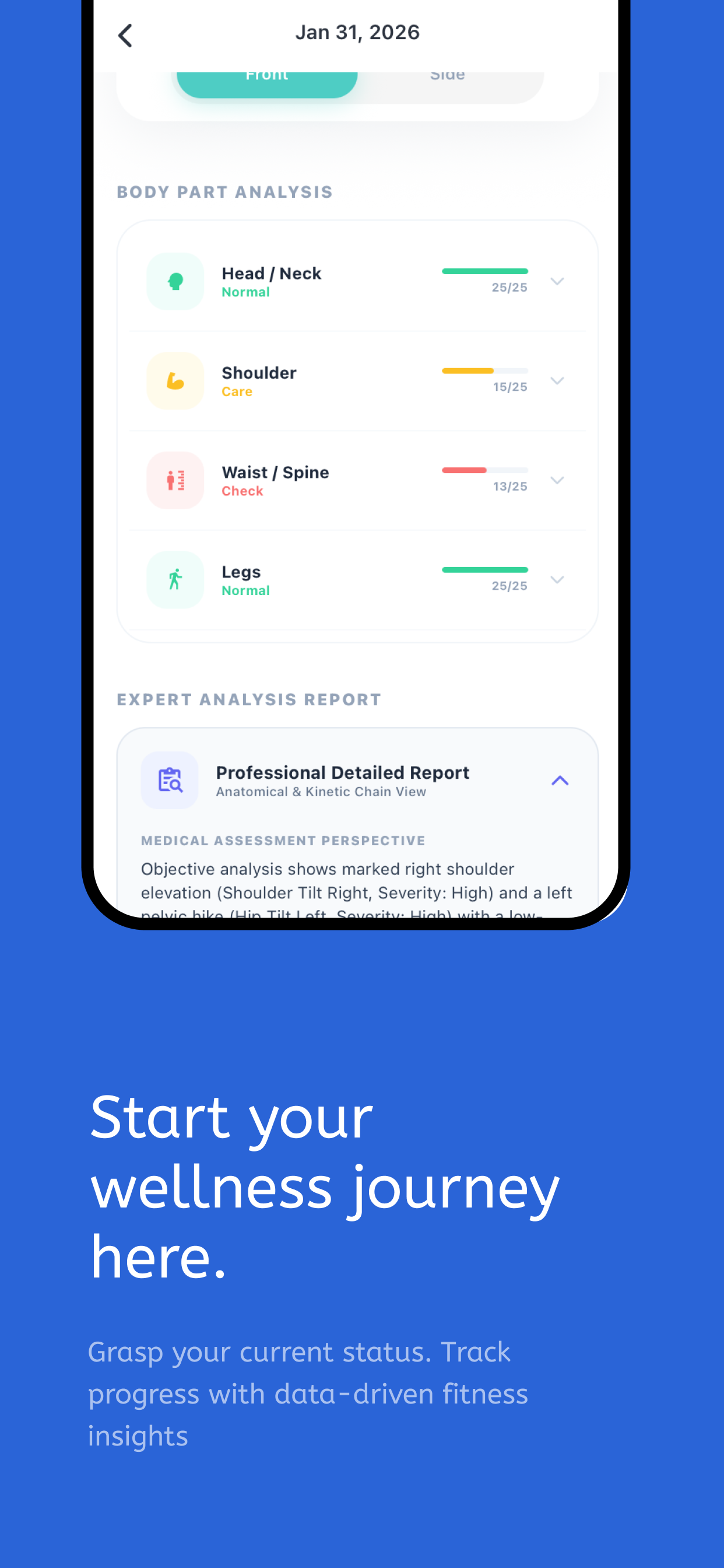 BioSkew: Body Check & Report