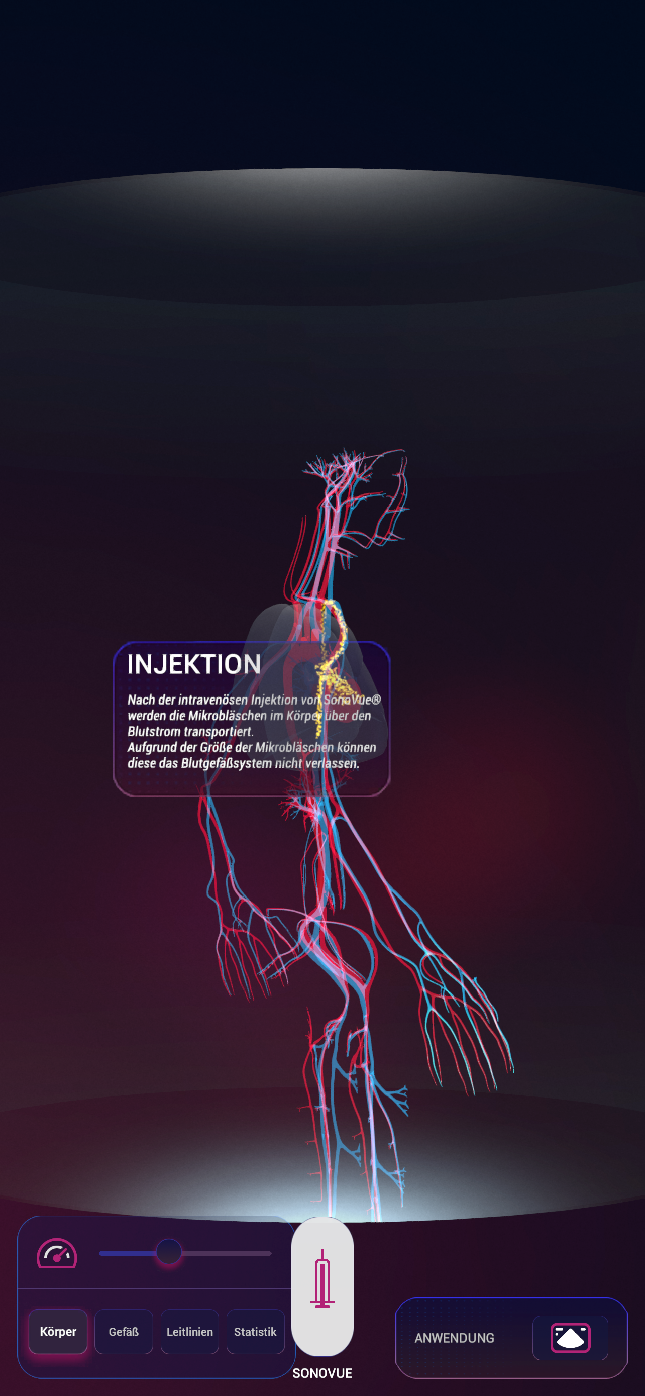 SonoVue screenshot 5