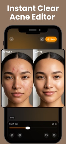 Acne Remover - Face Retouch Screenshot 2 of 6