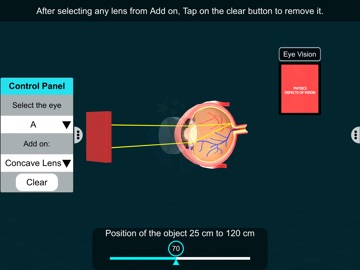 Vision Defects – EduTech Era iPad screenshot
