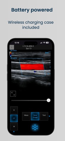 SpectrUs Screenshot 4 of 5