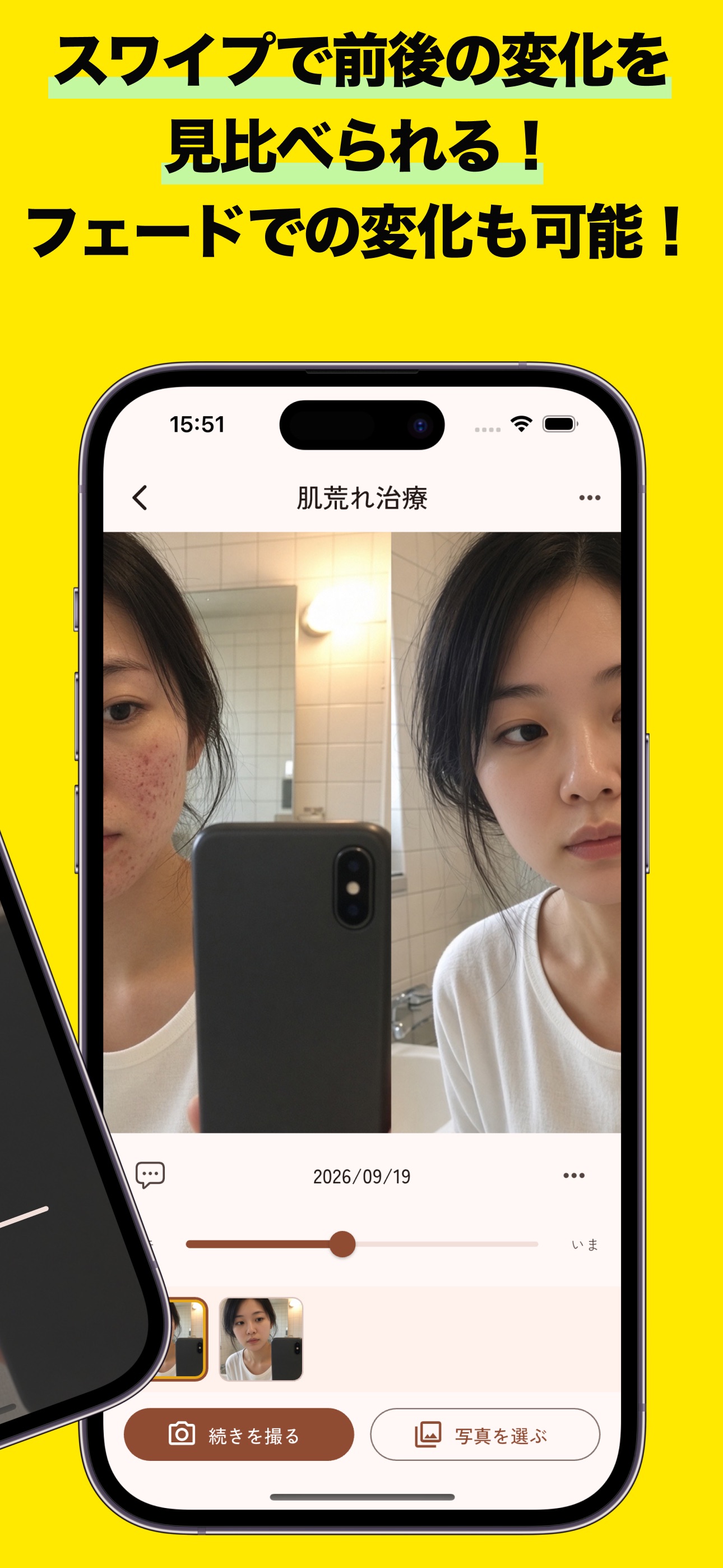 Screenshot 2 of Fadence - 美容やボディメイクの定点写真・成長記録