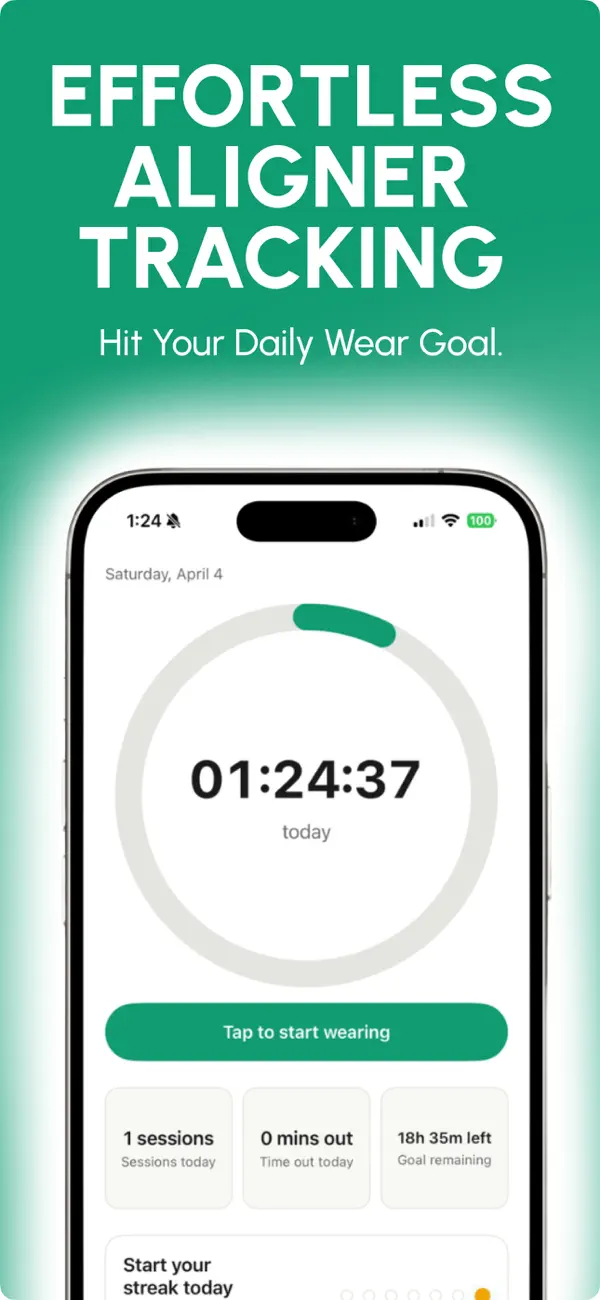 Screenshot #1 pour Aligner Tracker - Smilo
