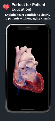 HeartVision Screenshot 2 of 3