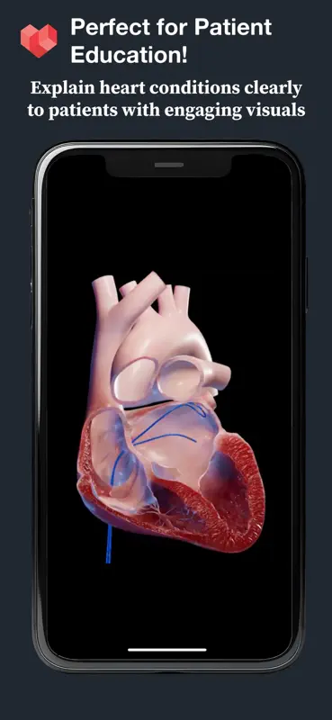 HeartVision screenshot 2 of 3