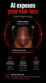 Hair Loss Scanner AI Check screenshot
