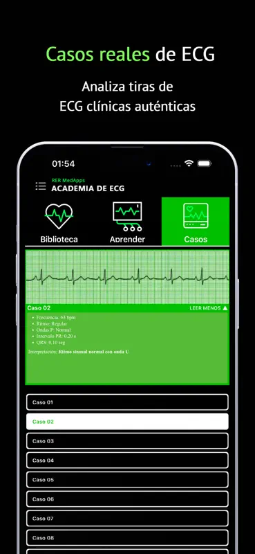 ECG Aprende Interpretación screenshot 2 of 5