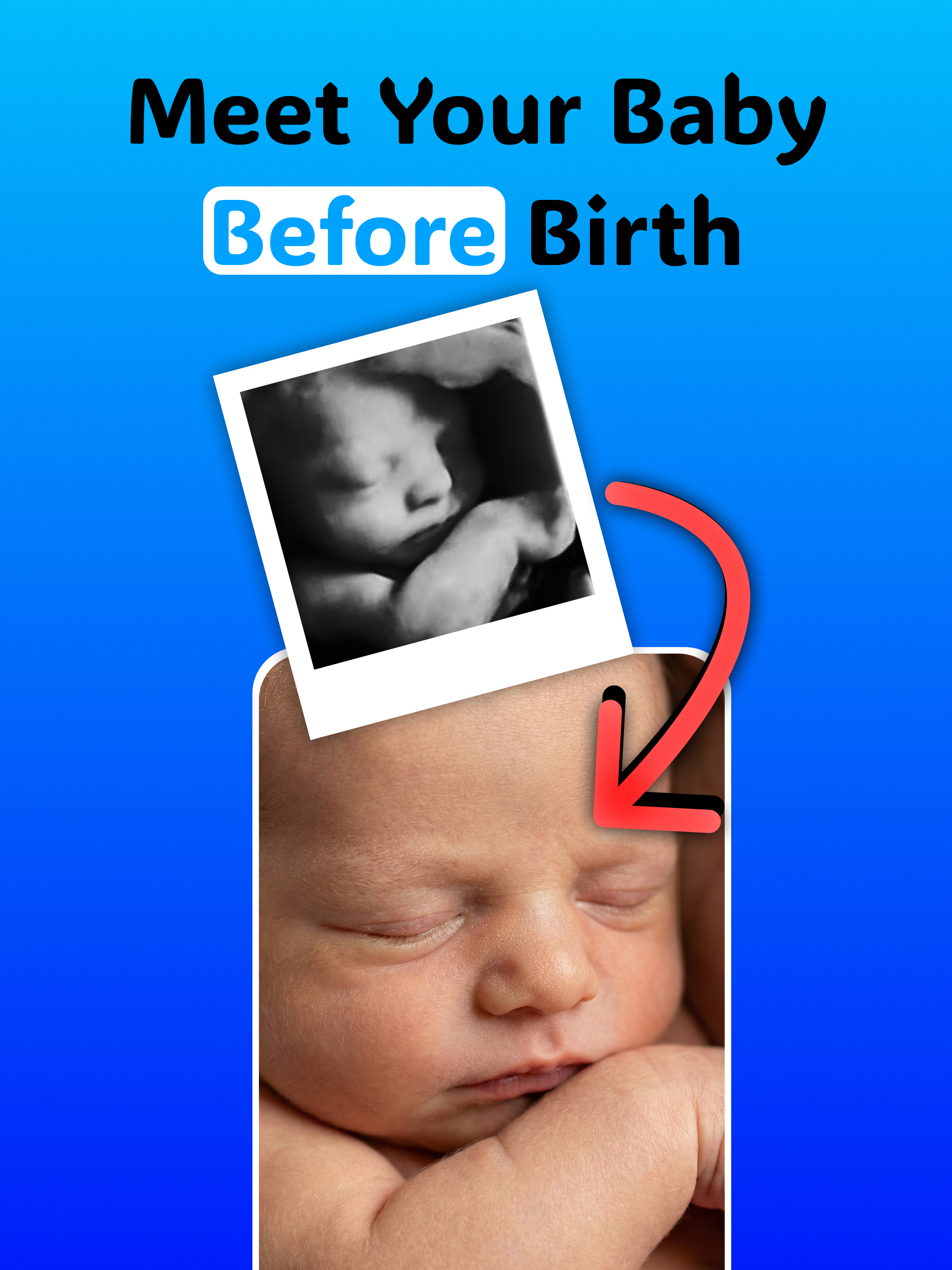 Ultrasound to Photo: BabyGuess