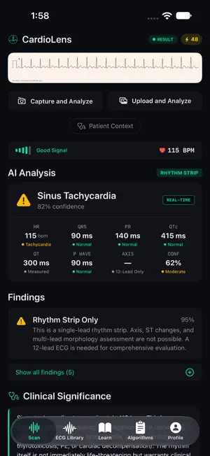 CardioLens screenshot 1