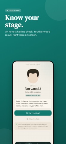 Hairline: Hair Loss Tracker iPhone screenshot