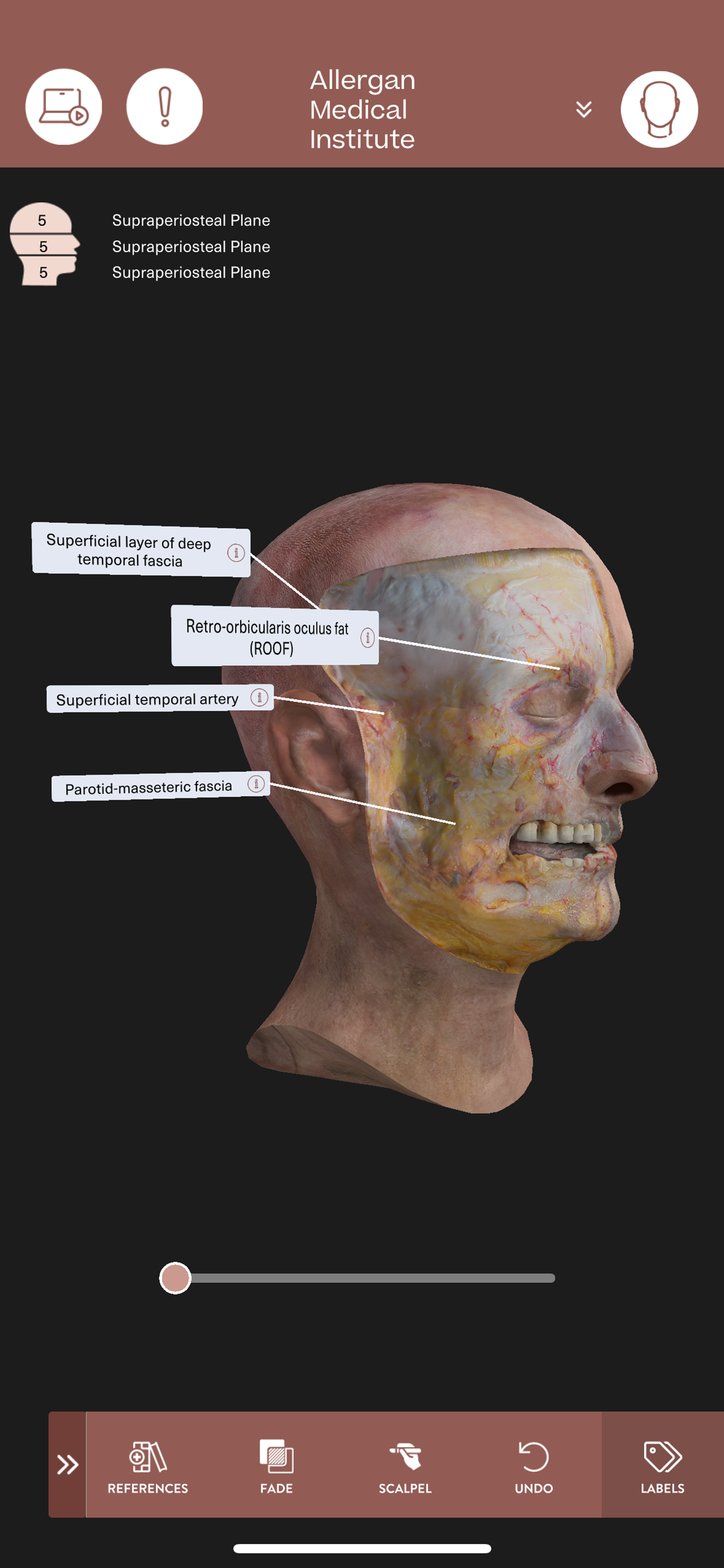 AMI Essentials: 3D Anatomy TH screenshot 9