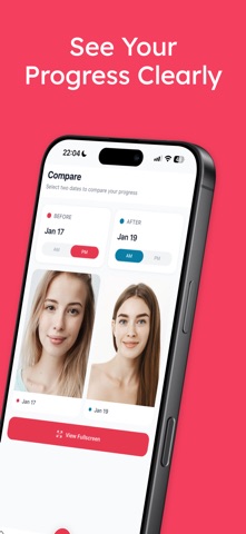 AI Skin Analyzer: SkinJourney iPhone screenshot